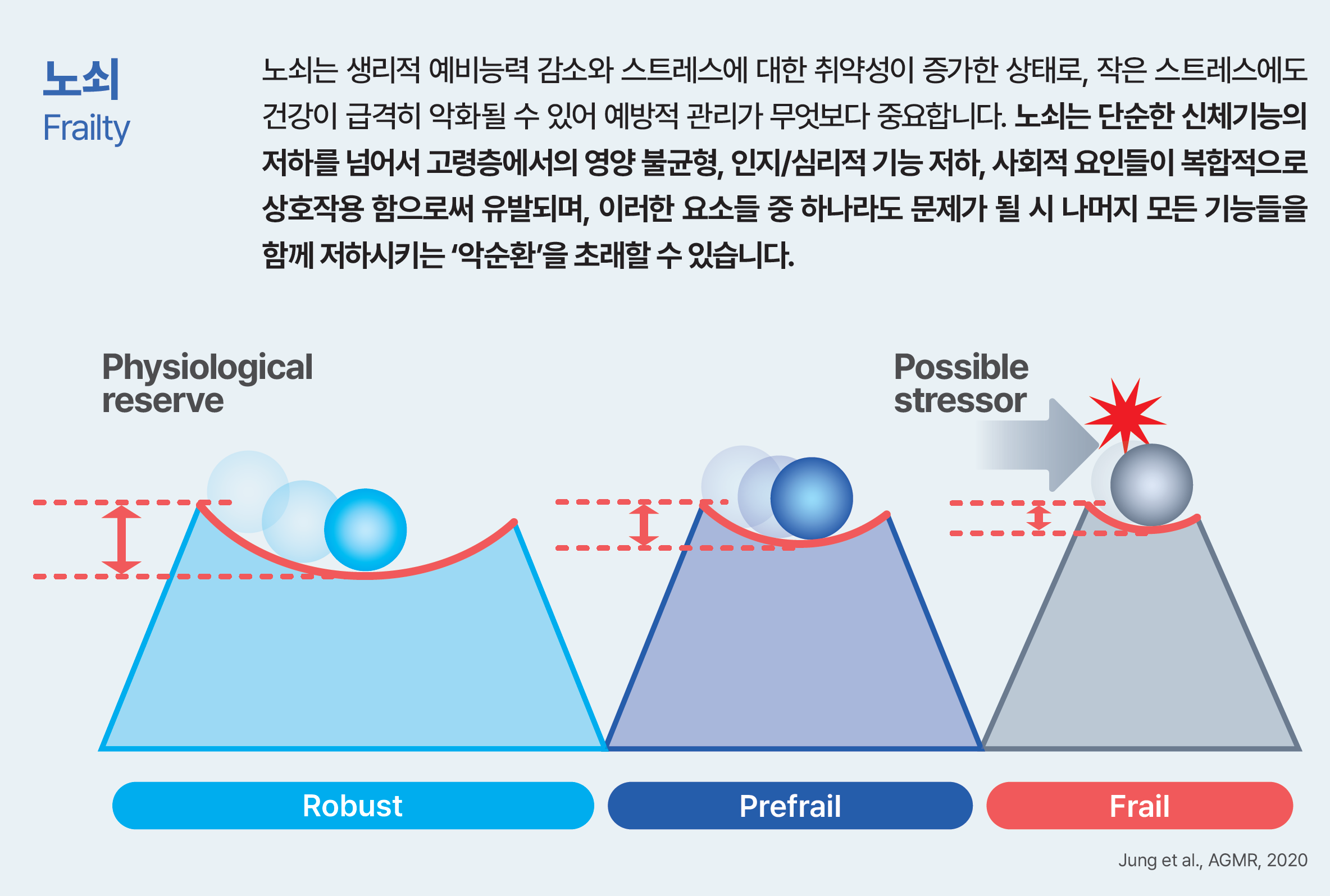 생리적 예비능력 감소에 따라 robust, prefrail, frail 상태에서 스트레스 반응이 달라지는 노쇠 개념 모델